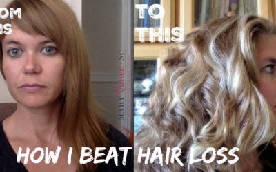 How I Beat Hair Loss & How You Can, Too
